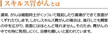 スキルス胃がんとは