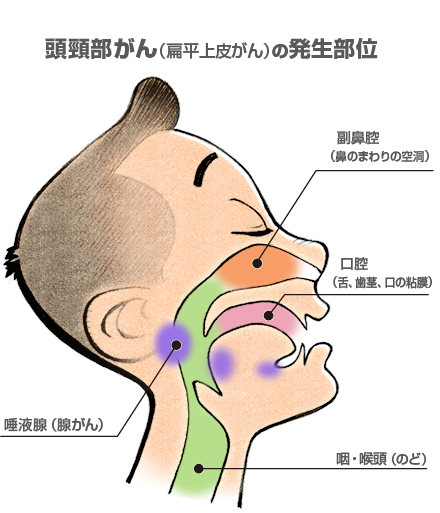 頭頸部がん